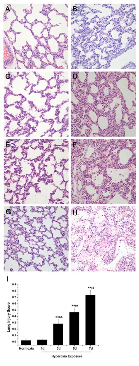 Lung Histology Shows Levels Of Lung Injury After Different Days Of