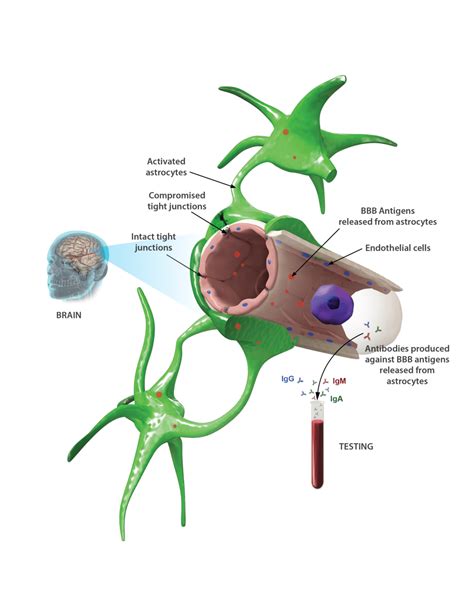 Cyrex Array Blood Brain Barrier Permeability Store Empowered