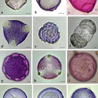 Pollen Microscope Slides