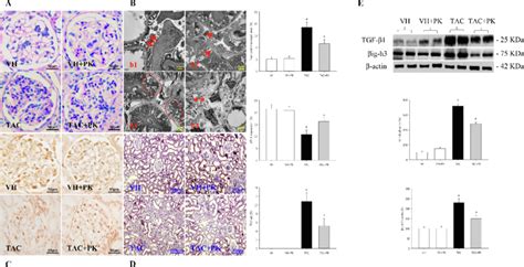 Representative Photomicrographs Of Pas Stain A Transmission Electron