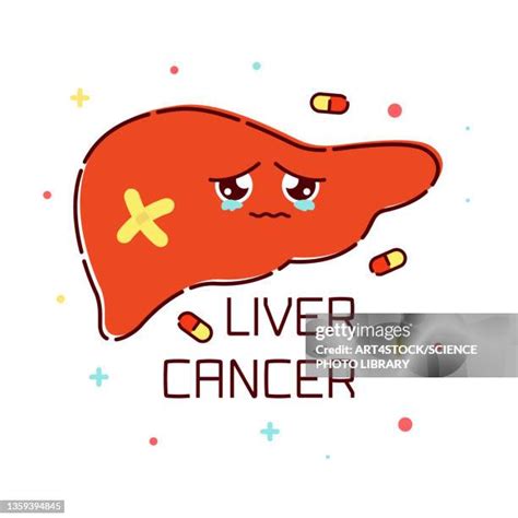 Liver Cancer High Res Illustrations Getty Images