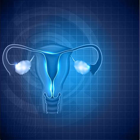 Maintenance Selinexor Monotherapy Improves PFS in Advanced Endometrial ...