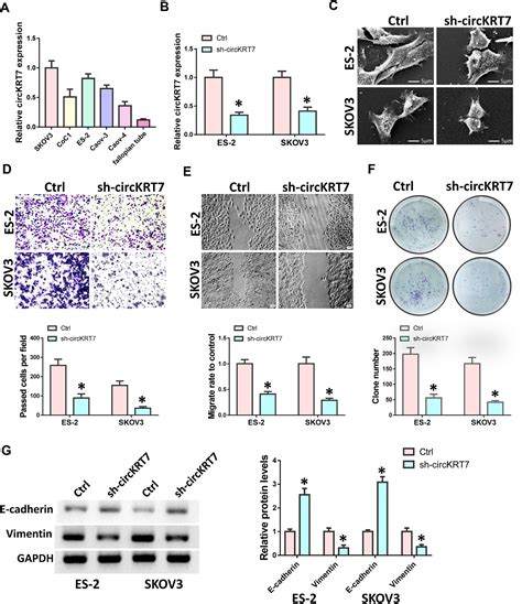 Figure 2 From CircKRT7 MiR 29a 3p COL1A1 Axis Promotes Ovarian Cancer