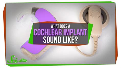 What Does A Cochlear Implant Sound Like Here You Go That Eric Alper