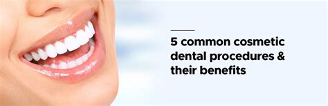 5 Common Cosmetic Dental Procedures And Their Benefits