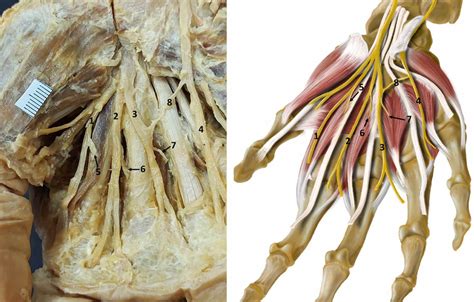Mano Derecha Nervio Dpp Li Nervio Dpc Del Segundo Espacio