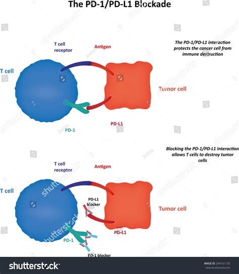 Cancer Immunotherapy Nivolumab Stock Vector (Royalty Free) 294161135 ...