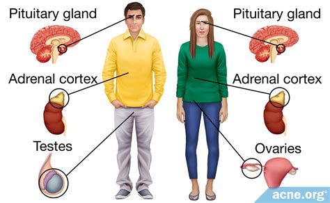 Hormones and Acne - Testosterone and Estrogen - Acne.org