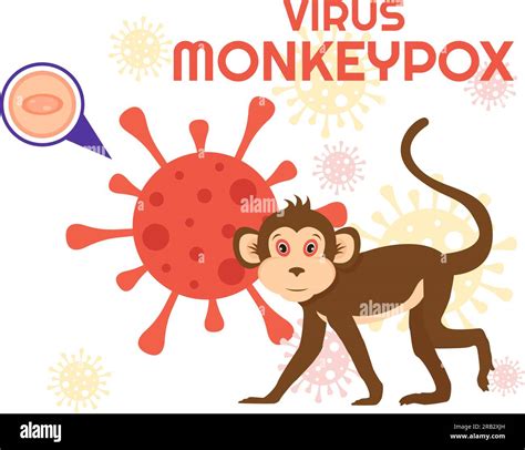 Monkey Pox Outbreak Vector Illustration Of Virus Symptoms In Humans