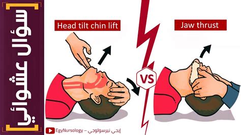 Head Tilt Chin Lift Maneuver Jaw Thrust Maneuver, 53% OFF