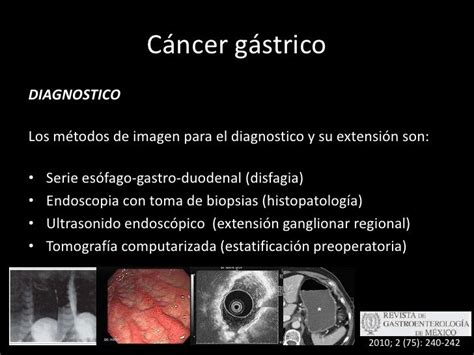 Cancer Gastrico