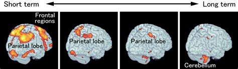 Long Term Memory Brain