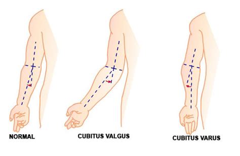 Functional Anatomy Exam 2 Chapter 6 Elbow And Forearm Flashcards