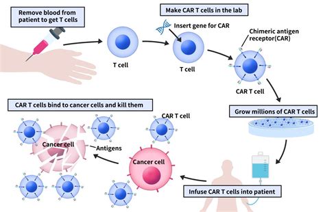 Unraveling The Mystery Of Million Dollar Car T Therapy Dima