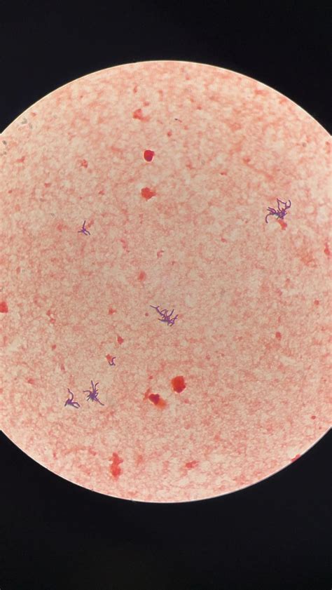 Gram stain help? Positive blood cx anaerobic bottle. GPRs? Never seen ...