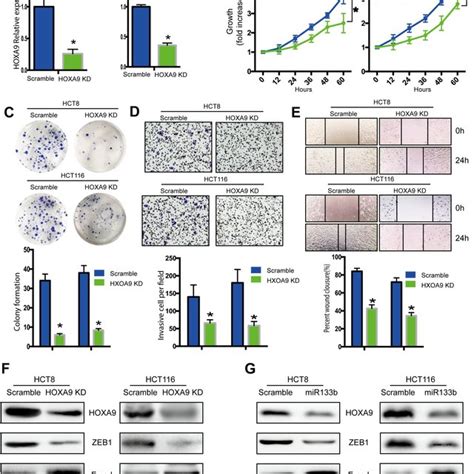 Mir 133b Suppresses Crc Tumorigenesis And Metastasis In Vivo Hct8 And