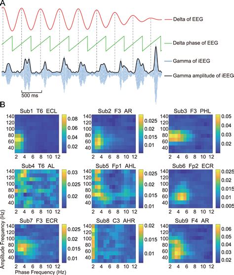 Phase Amplitude Coupling Between Low Frequency Scalp Eeg And High