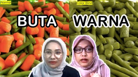 Apakah Penyakit Buta Warna Bisa Disembuhkan YouTube