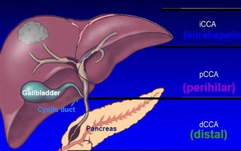 Gi Cancers Flashcards Quizlet