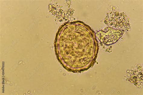 Foto De Egg Of Ascaris Lumbricoides In Stool Analyze By Microscope Do