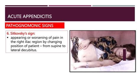 Acute Appendicitis Anatomy Aetiology Types Clinical Features Pptx