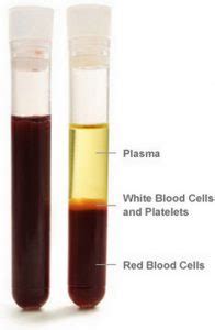 Difference between Serum and Plasma - Laboratoryinfo.com