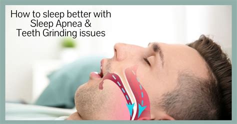 How To Sleep Better With Sleep Apnea And Teeth Grinding Issues Expert