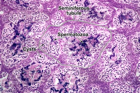 Rana Sp Frog Testicle Transverse Section 250x Rana Sp Frog