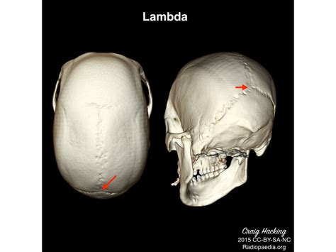 Image Radiopaedia Org