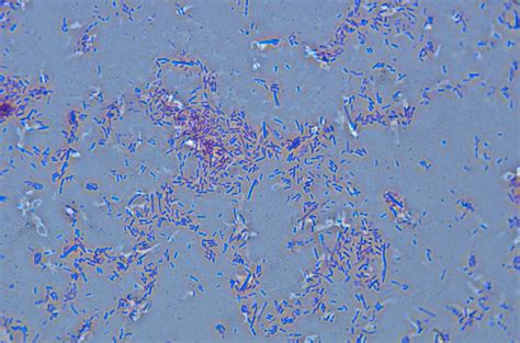 Lactobacillus Acidophilus, Lm Photograph by Michael Abbey - Pixels