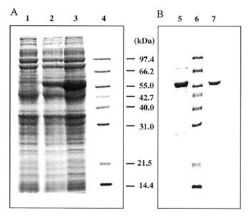 SDS PAGE Of Protein Samples From E Coli BL21 DE3 Transformed By