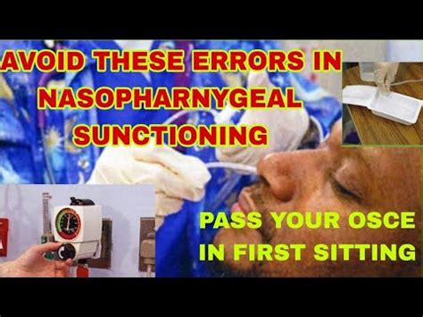 Nasopharyngeal Suctioning Nmc Osce Made Easy Pass Your Osce In First