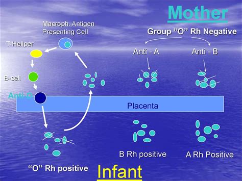 Haemolytic Disease Of The Fetus And Newborn Rh Isoimmunization