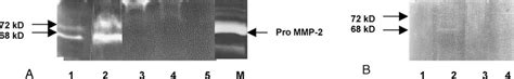 Assay Of Mmp 2 Activity In Whole Cell Extract By Gelatin Zymography Download Scientific