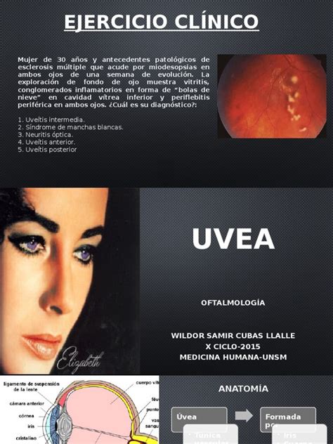 Patologías De La Uvea Descargar Gratis Pdf Ojo Humano