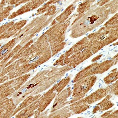 Function Of Phospholamban Pln Pln Is A Reversibly Phosphorylated