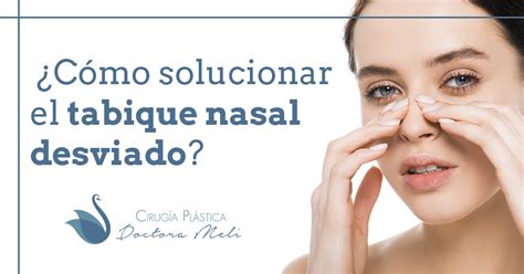 Cómo solucionar el tabique nasal desviado Doctora Meli