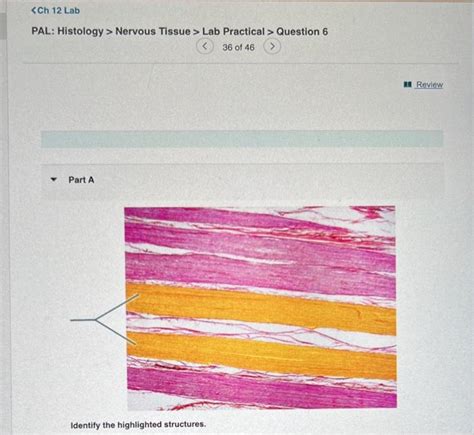 Solved Pal Histology Nervous Tissue Lab Practical Chegg