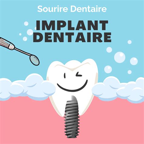 Meilleur Clinique Pour Implant Dentaire Sourire Dentaire