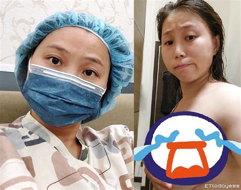 驚揭罹癌她手捧「瘀青豪乳」將切除：為了老婆孩子願跟大咪咪說掰 Ettoday健康雲 Ettoday新聞雲