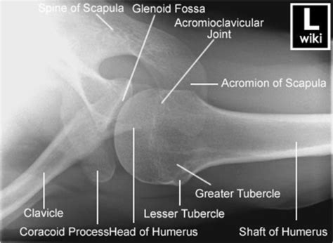 Medical Imaging Radiographs Flashcards Quizlet