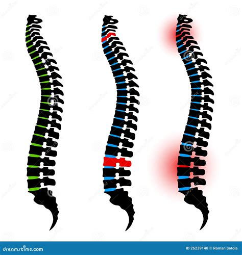 DIAGRAM Diagrama De Espina Dorsal MYDIAGRAM ONLINE