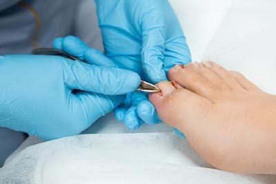 Conditions Treated By Podiatrists From Ingrown Toenails To Plantar