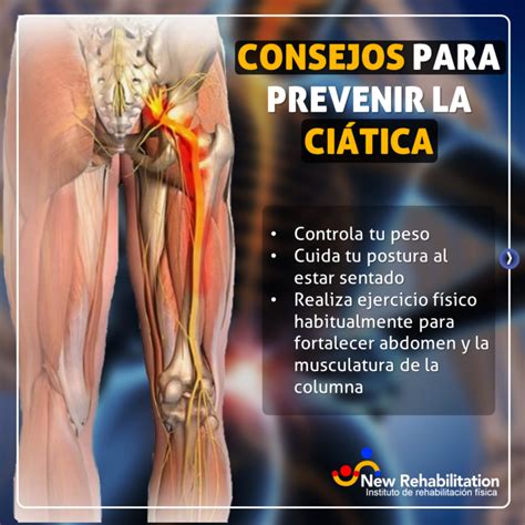 CIÁTICA O DOLOR HACIA LA PIERNA New Rehabilitation