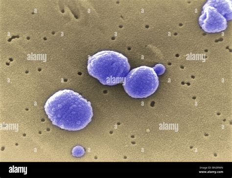 An Lisis Micrograf A De Electrones Sem De Bacterias Gram Positivas La