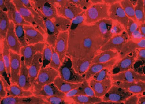 Huvec Human Umbilical Vein Endothelial Cells Promocell