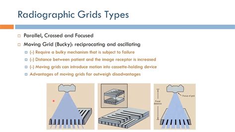 Short Topics In X Ray Imaging Radiographic Grid Types Arabic