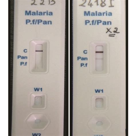 The Prevalence Of Non Falciparum Malaria Among Giza Population