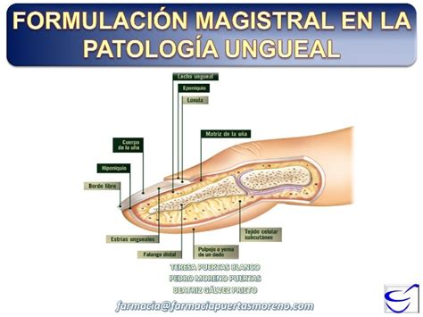 Patología Ungueal En Formulacion Magistral Teresa Puertas Aedsc 2