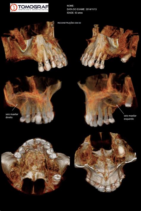 Tomograf Radiologia Odontológica | Porto Alegre RS